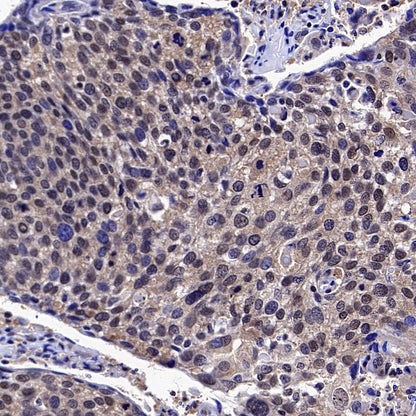 IRF3 Recombinant Rabbit mAb (S-3650-63)