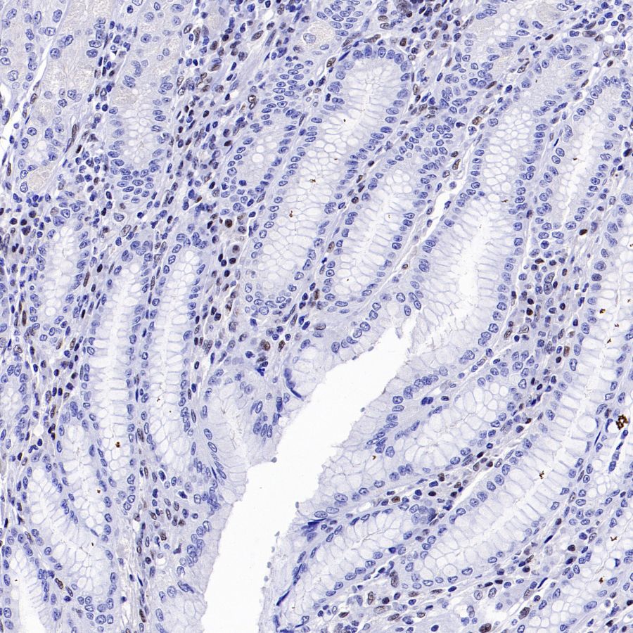 SLFN11 Recombinant Mouse mAb (S-1565-283)