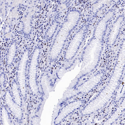 SLFN11 Recombinant Mouse mAb (S-1565-283)
