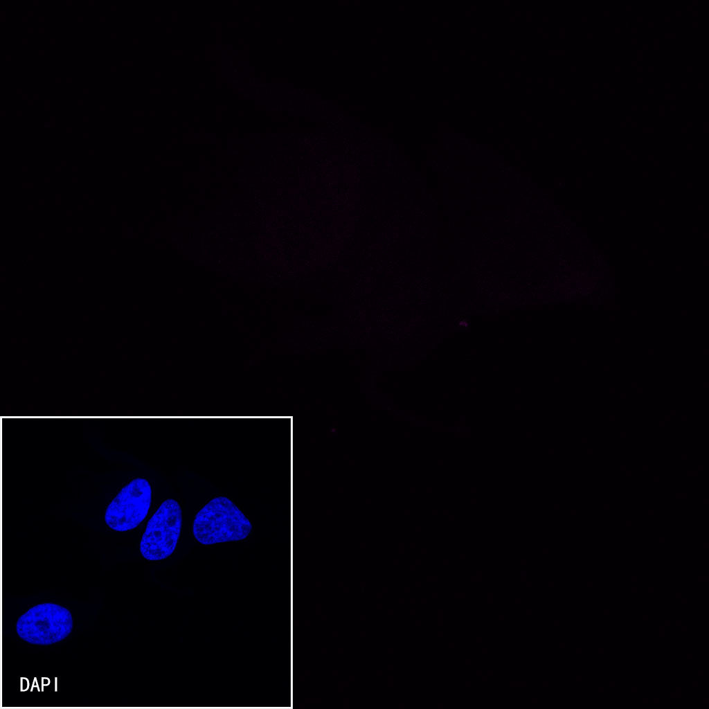 CD38 Recombinant Rabbit mAb (Alexa Fluor® 647 Conjugate) (SDT-031-45-2)
