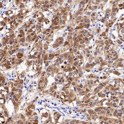 CDKN2A/p16 INK4A Recombinant Mouse mAb (SDT-4675)