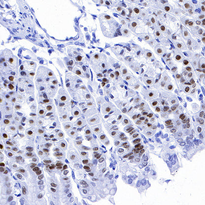 FOXA2 Recombinant Rabbit mAb (SDT-R174)