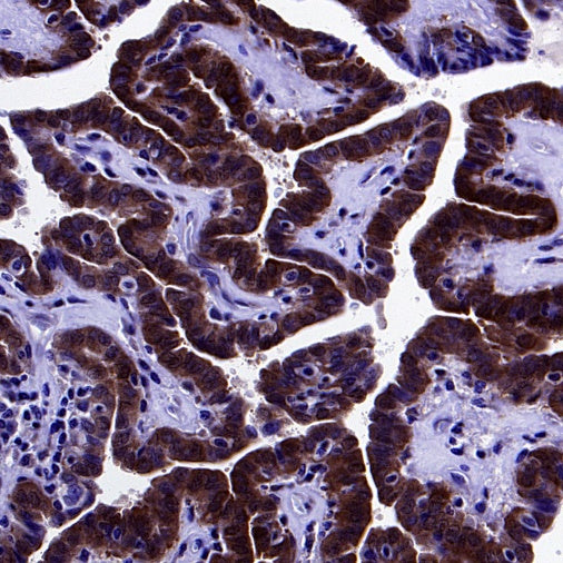 PSAP Recombinant Rabbit mAb (S-2399-11)