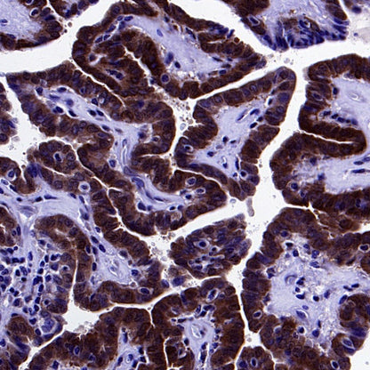 PSAP Recombinant Rabbit mAb (S-2399-11)