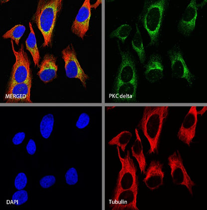 PKC delta Recombinant Rabbit mAb (S-1667-50)