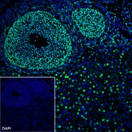FOXL2 Recombinant Rabbit mAb (SDT-557-361)