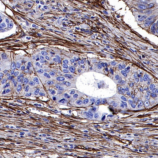 Integrin beta1/CD29 Recombinant Rabbit mAb (SDT-255-52)