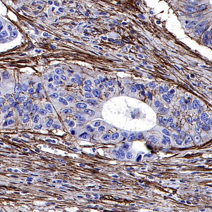Integrin beta1/CD29 Recombinant Rabbit mAb (SDT-255-52)