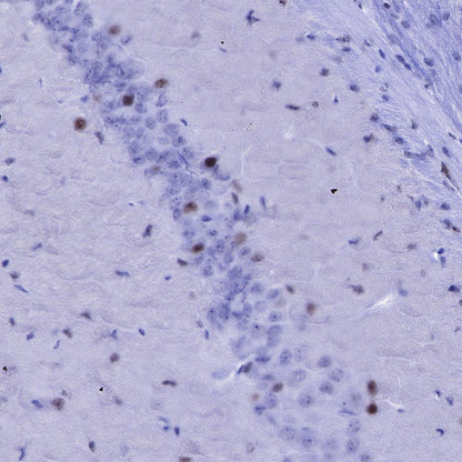 SOX1 Recombinant Rabbit mAb (S-R310)