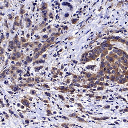 AMPKβ1/2 Recombinant Rabbit mAb (S-2728-26)