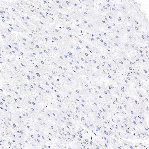 MMP7 Recombinant Rabbit mAb (S-1628-25)