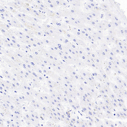 MMP7 Recombinant Rabbit mAb (S-1628-25)