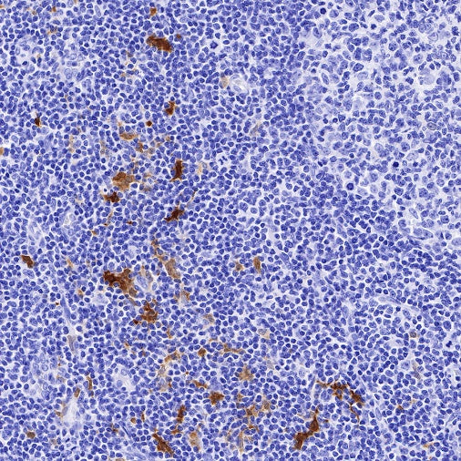 IDO1/Indoleamine 2,3-dioxygenase Recombinant Rabbit mAb (S-R225)