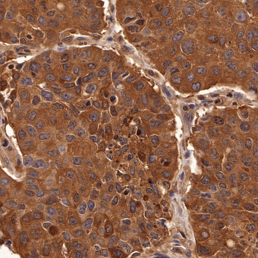 p38 MAPK Recombinant Rabbit mAb (S-508-19)