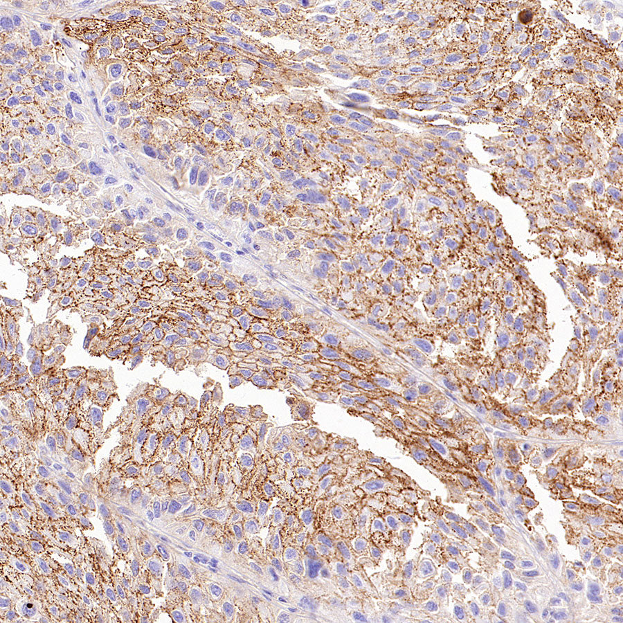 Desmoglein 3 Recombinant Rabbit mAb (SDT-3213-33)