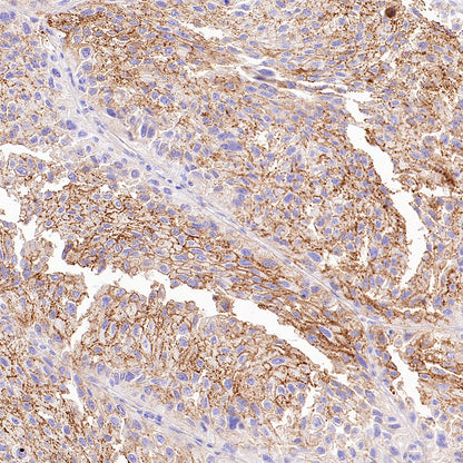 Desmoglein 3 Recombinant Rabbit mAb (SDT-3213-33)