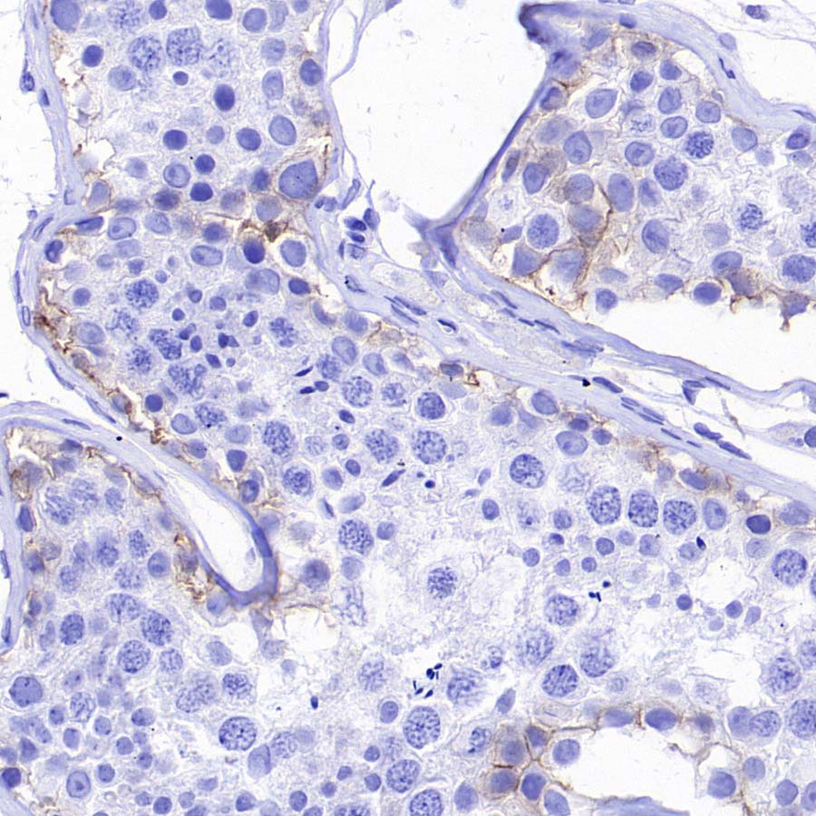 ABCC1/MRP1 Recombinant Rabbit mAb (SDT-4056-11)