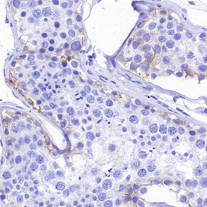 ABCC1/MRP1 Recombinant Rabbit mAb (SDT-4056-11)