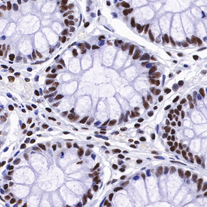 Ku80 Recombinant Rabbit mAb (S-R226)