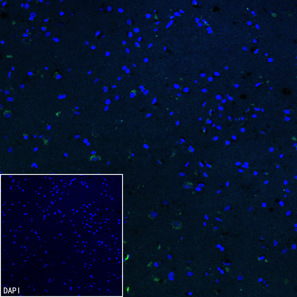 CD206 Recombinant Rabbit mAb (S-3477-27)