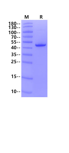 MAT1A His Tag Protein, Human