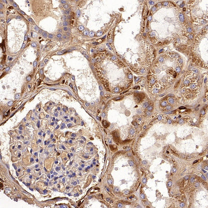 SFRP1 Recombinant Rabbit mAb (S-3071-18)