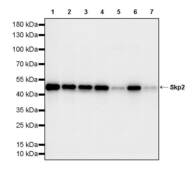 Skp2 Recombinant Rabbit mAb (S-4906)
