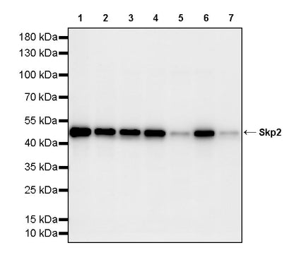 Skp2 Recombinant Rabbit mAb (S-4906)