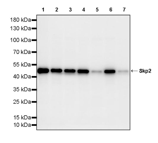 Skp2 Recombinant Rabbit mAb (S-4906)