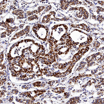 VDAC1 + VDAC2 + VDAC3 Rabbit Polyclonal Antibody