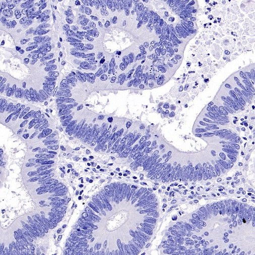 ALPG Rabbit Polyclonal Antibody