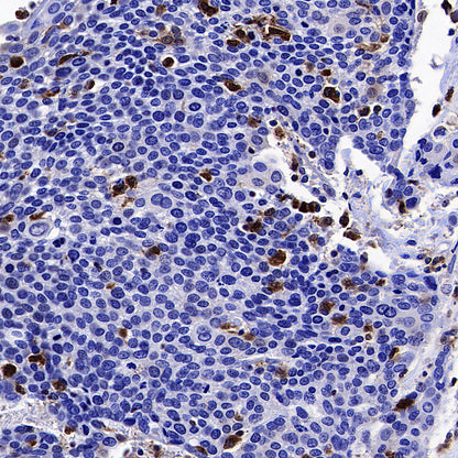 ISG15 Recombinant Rabbit mAb (S-5475)