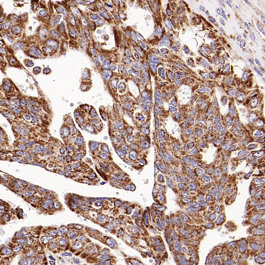 VDAC3 Rabbit Polyclonal Antibody