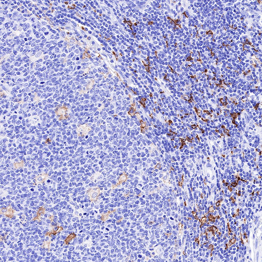 CD163 Recombinant Rabbit mAb,PBS Only (SDT-327-58)