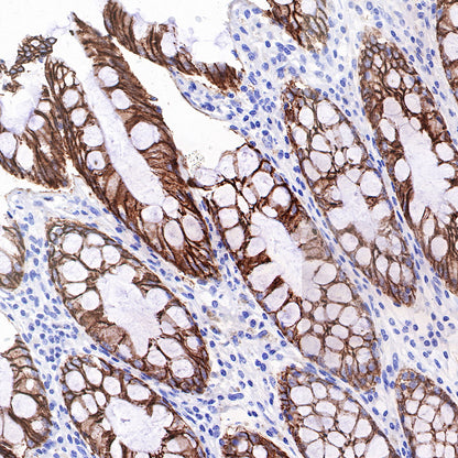 Cadherin 17 Recombinant Rabbit mAb,PBS Only (SDT-R151)