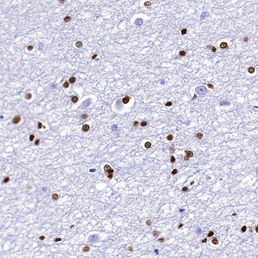 Olig2 Recombinant Rabbit mAb (SDT-648-155)