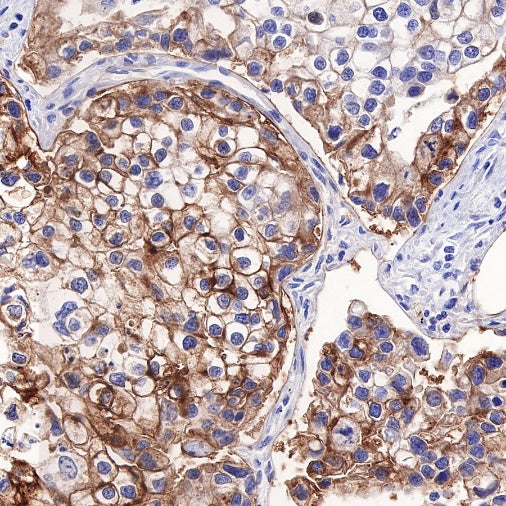 Tissue factor Recombinant Rabbit mAb (S-893-34)