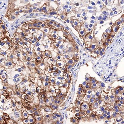 Tissue factor Recombinant Rabbit mAb (S-893-34)