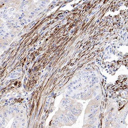 Ferritin Light Chain Recombinant Rabbit mAb (S-1879-19)