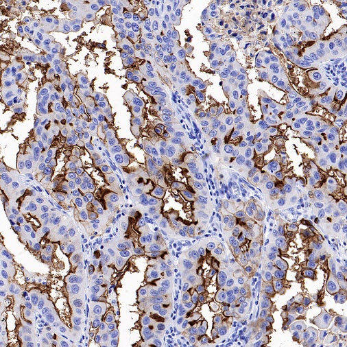 NaPi2b/SLC34A2 Recombinant Rabbit mAb (SDT-1771-79)