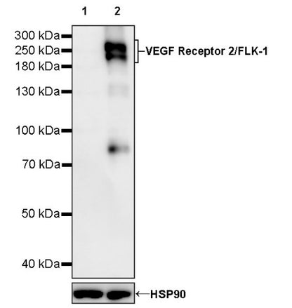 VEGF Receptor 2/FLK-1 Recombinant Rabbit mAb (S-1519-34)