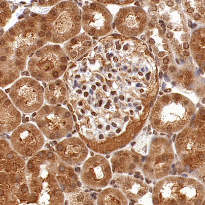 AMPK α1 Rabbit Polyclonal Antibody