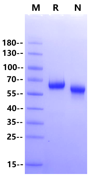 MMP-9 (20-471) His Tag Protein, Mouse