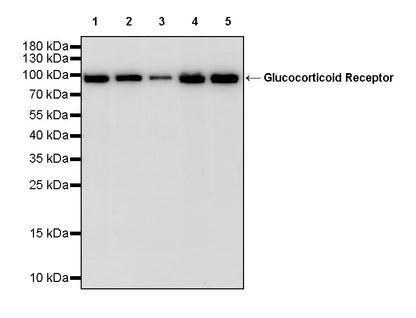 Glucocorticoid Receptor Recombinant Rabbit mAb (S-M0030)