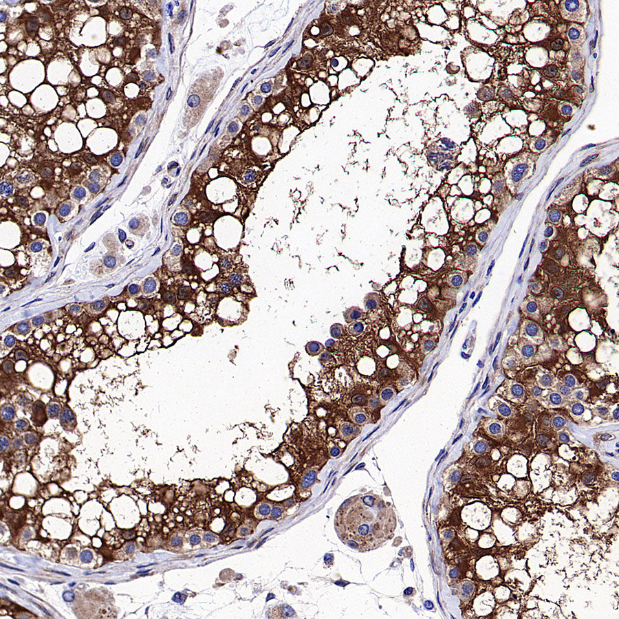 Vinculin Recombinant Rabbit mAb (S-5405)