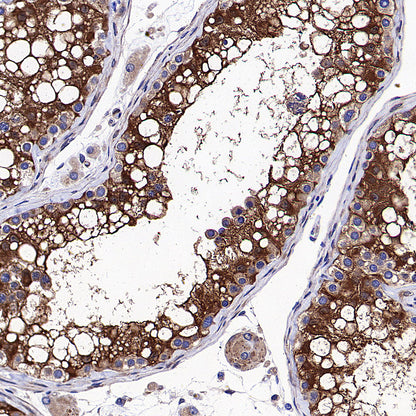 Vinculin Recombinant Rabbit mAb (S-5405)