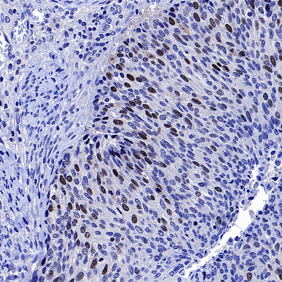 Skp2 Recombinant Rabbit mAb (S-4906)