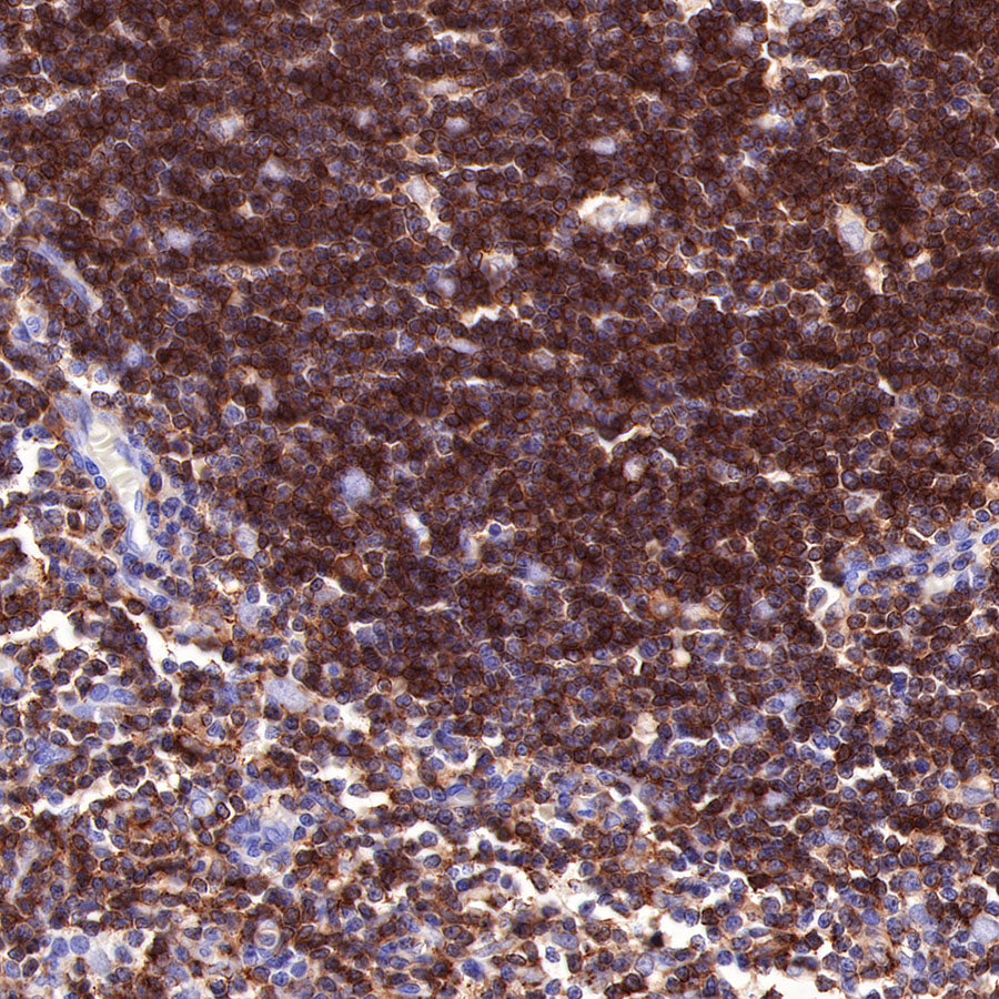 CD4 Recombinant Rabbit mAb,PBS Only (SDT-R163)