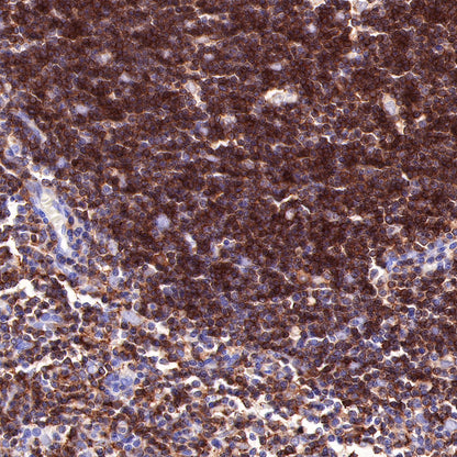 CD4 Recombinant Rabbit mAb,PBS Only (SDT-R163)