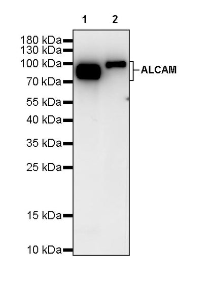ALCAM Recombinant Rabbit mAb (S-4080-40)